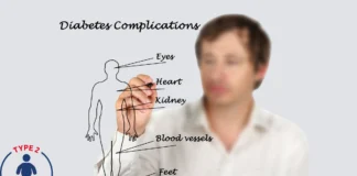 Type 2 Diabetes